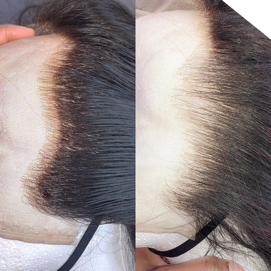 Epilation + décoloration des noeuds