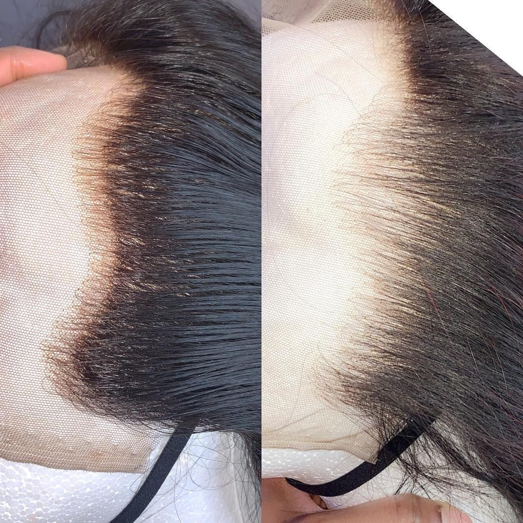 Epilation + décoloration des noeuds